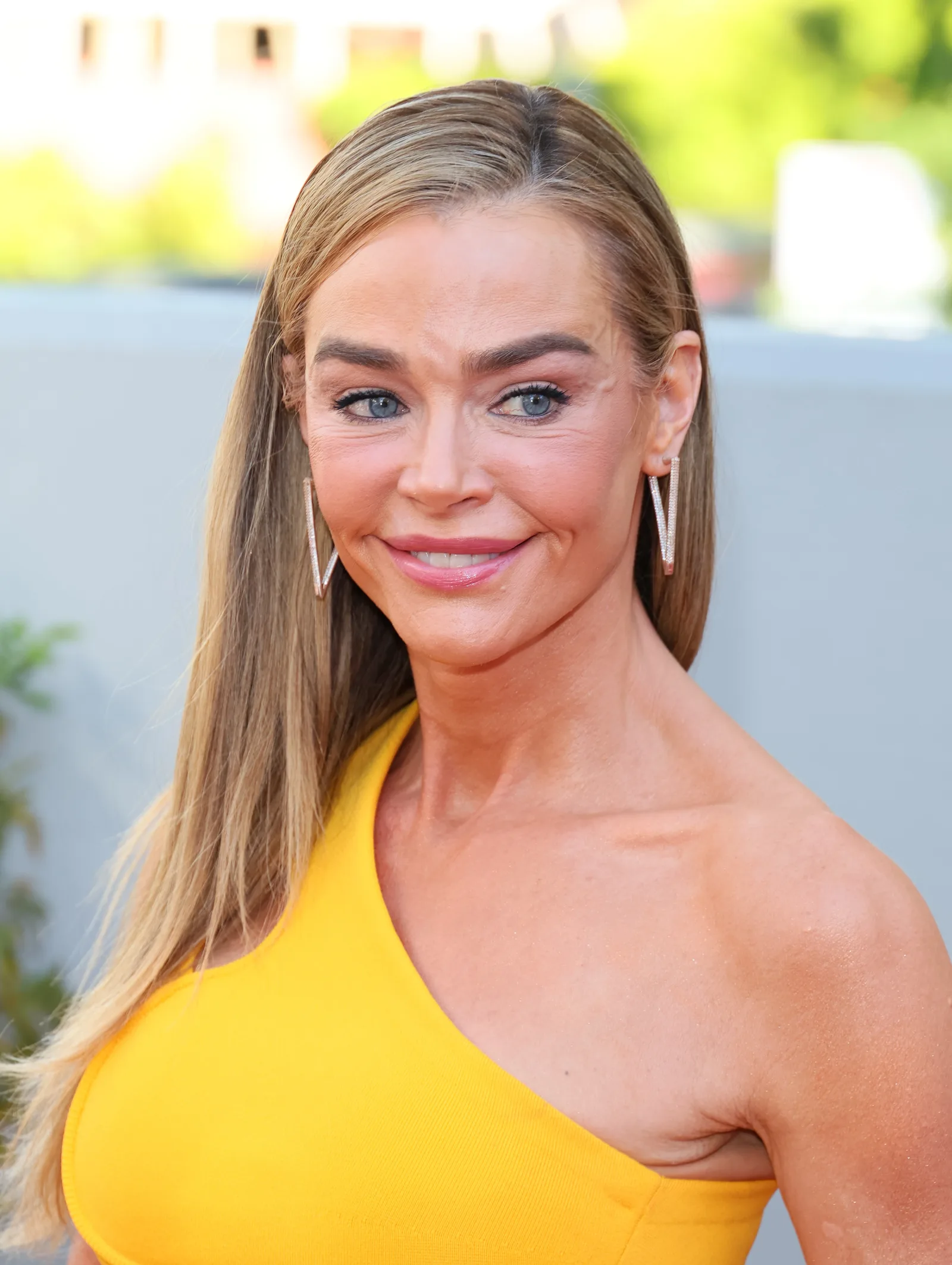 Richards' post-surgery appearances reflected the result she said she had requested. Her aim was to look refreshed and recognizable, not transformed into someone else.