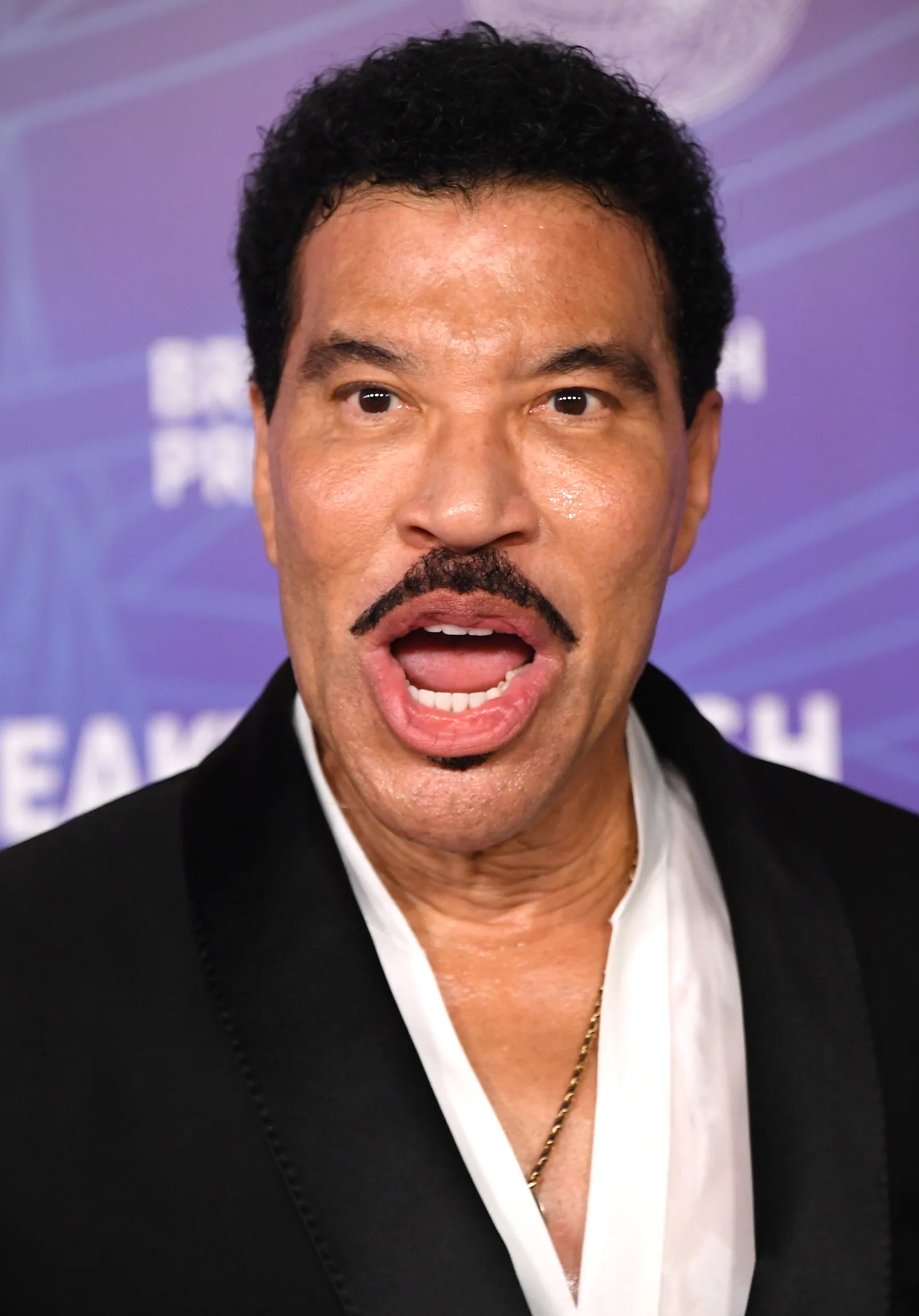 Months before his St. Louis performance ended with Richie sitting through part of his closing number, the singer remained active onstage and at public events. This April 2026 appearance at the Breakthrough Prize Ceremony captured him during the same year that brought two separate concert health scares.
